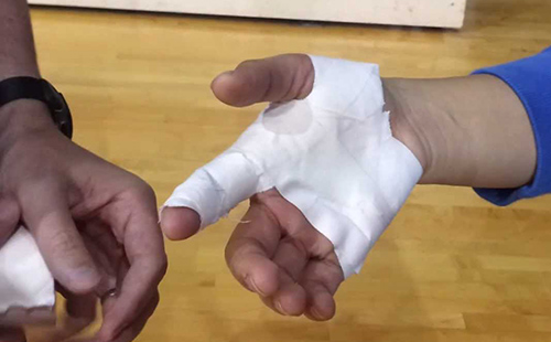 故意傷害輕傷怎么判刑？(圖1)